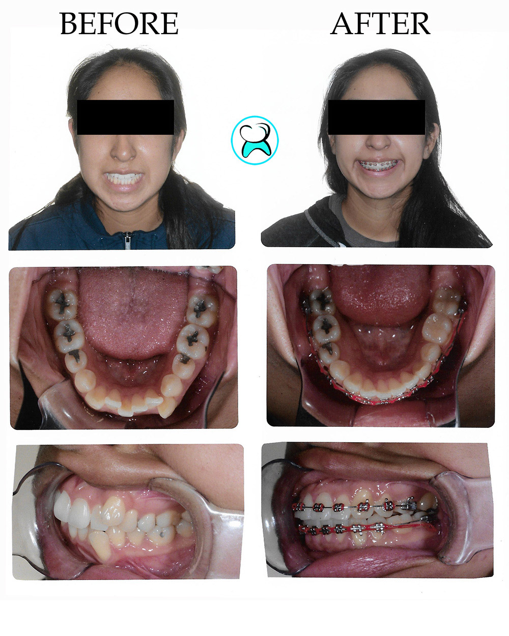 Dentist in Duarte CA Before After Photos