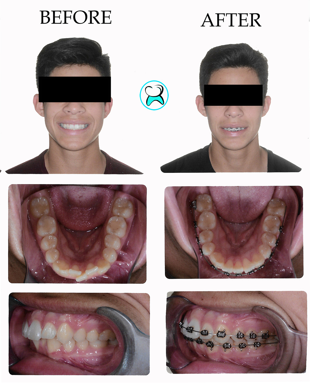 Dentist in Duarte CA Before After Photos